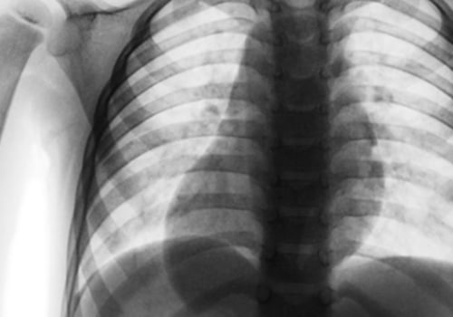 How Long Does an Urgent X-Ray Take to Come Back?